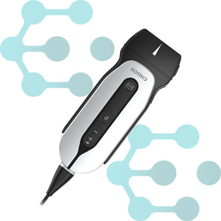 ULTRASSOM SONOEYE P2