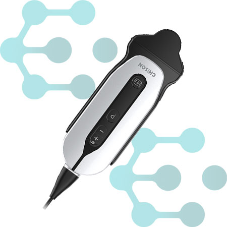 ULTRASSOM SONOEYE P6